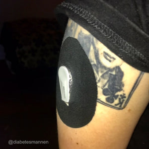 PATCHES för Dexcom G6