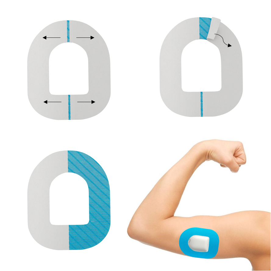 PATCHES för Omnipod